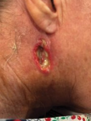 Case photo, Aug 12