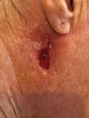 Case photo, Aug 14