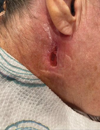Case photo, Aug 18