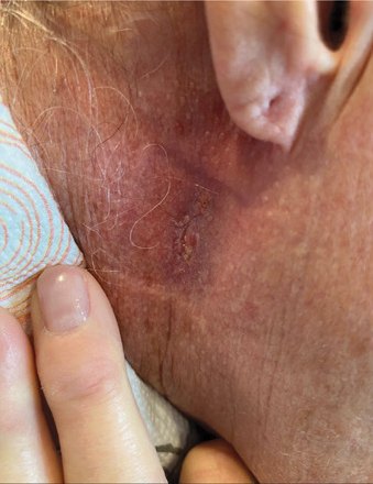 Case photo, Sep 3